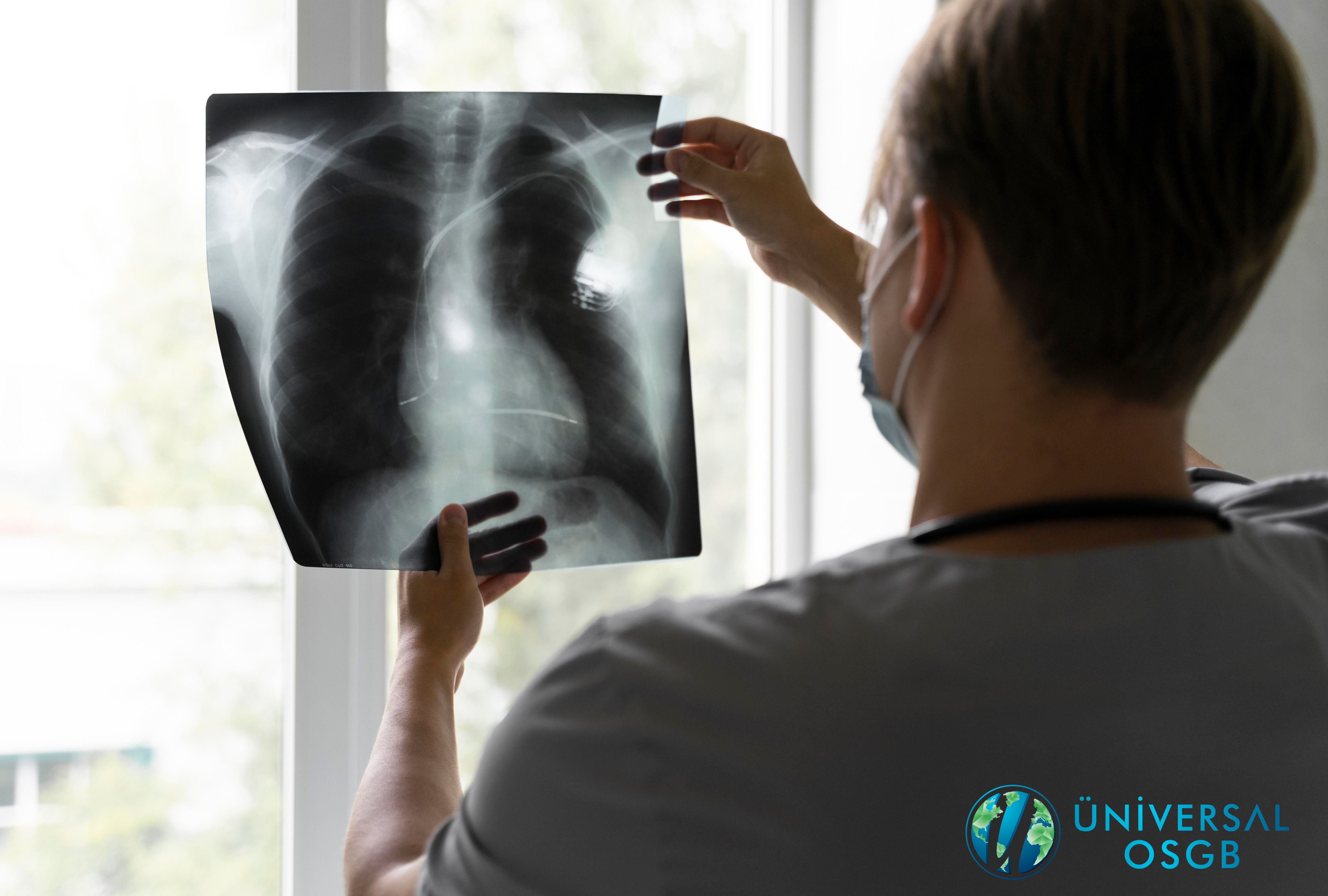 Sık Çekilen Akciğer Grafilerinde Alınan Radyasyonunun İnsan Sağlığı Üzerindeki Etkileri